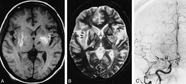 fig 3.