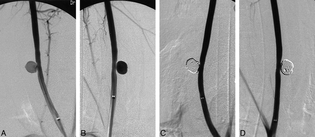 fig 2.