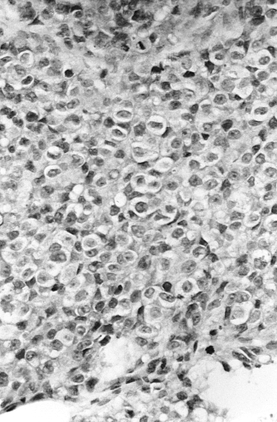 fig 4.