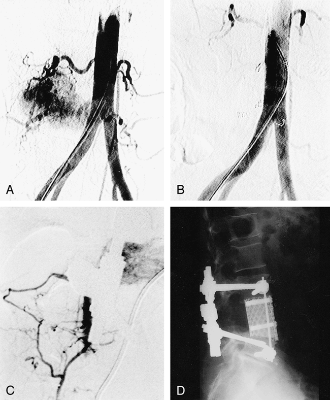 fig 3.