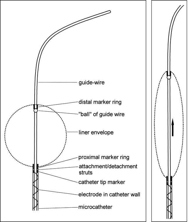 fig 1.