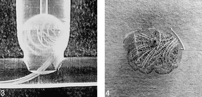 fig 3.