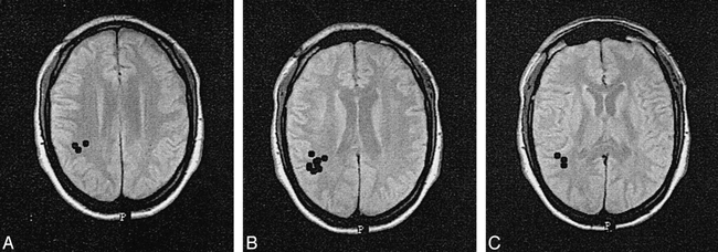 fig 3.
