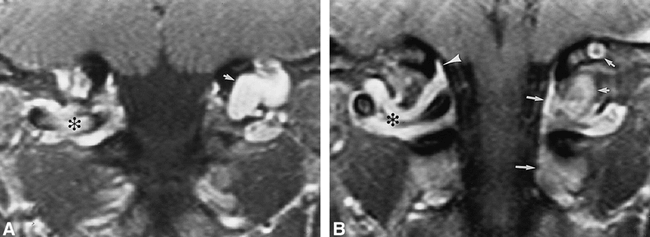 fig 2.