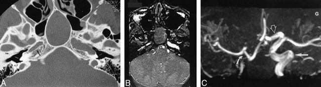fig 2.