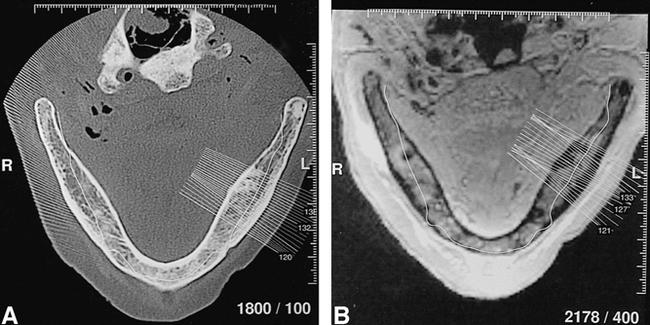 fig 2.