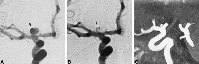 fig 2.