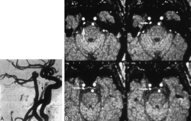fig 1.