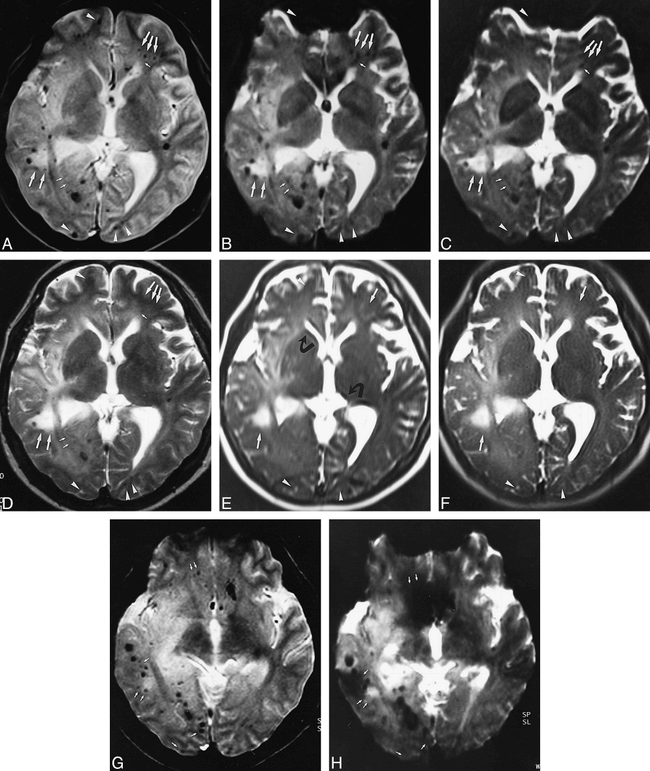 fig 3.