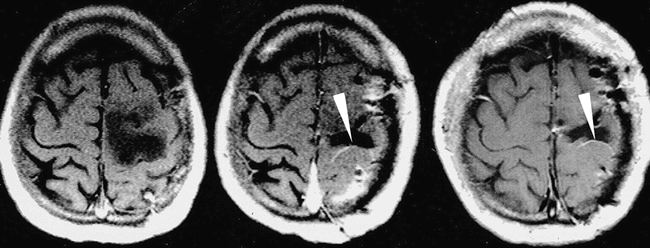 fig 1.