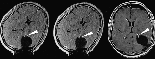 fig 2.