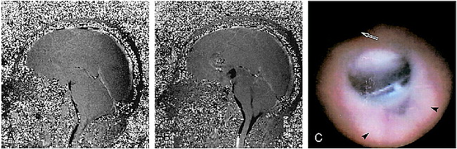 fig 4.