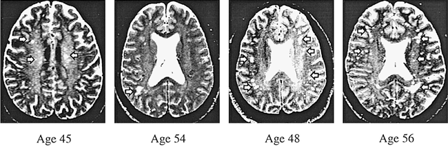 fig 2.