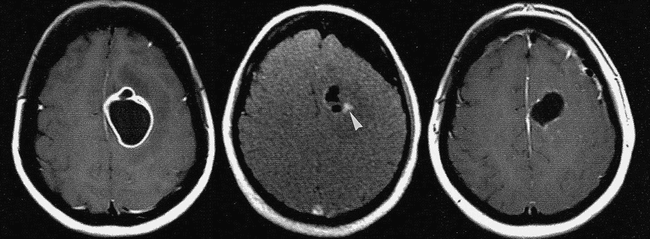 fig 2.