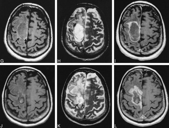 fig 4.