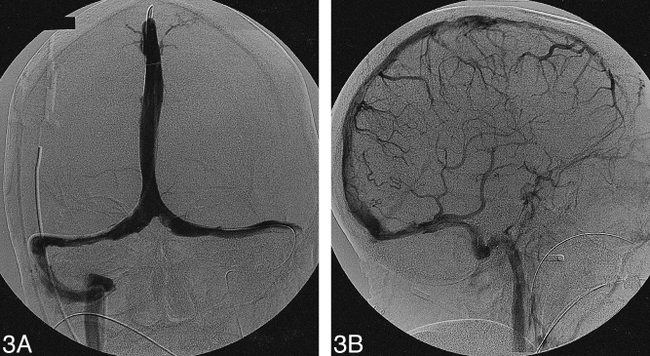 fig 3.