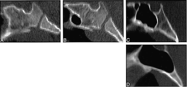 fig 1.