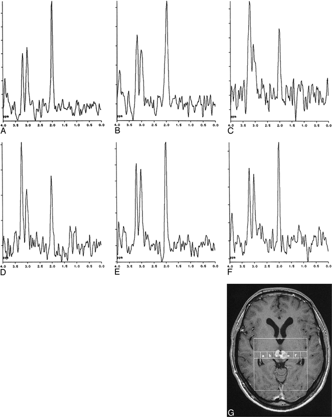 fig 1.