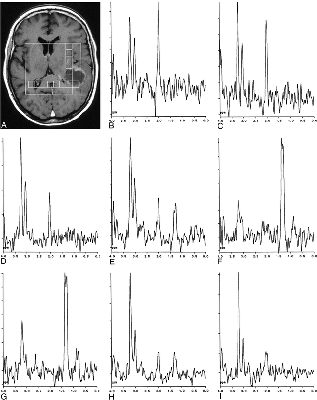 fig 2.