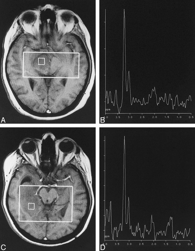 fig 4.
