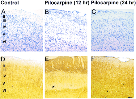 fig 6.