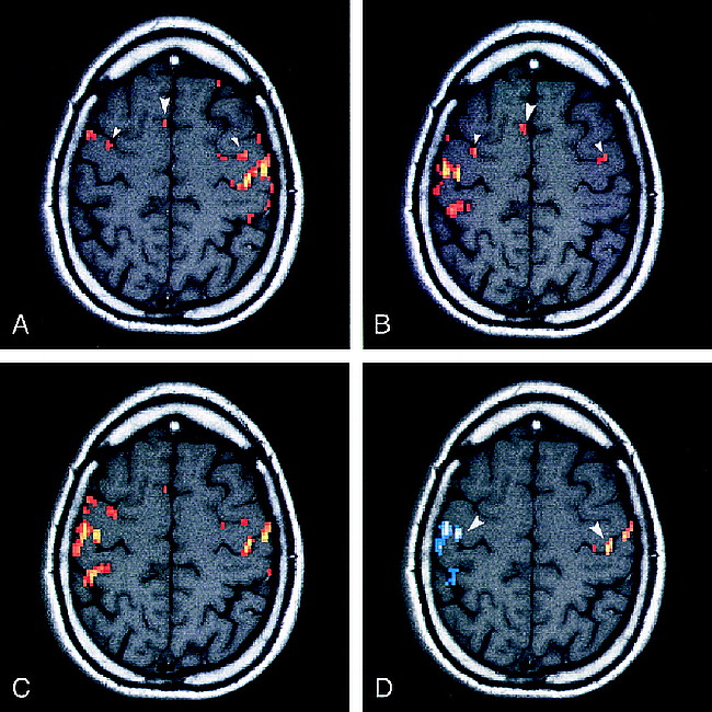 fig 1.