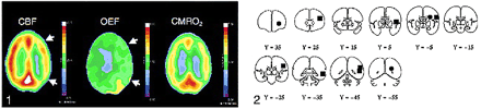fig 1.