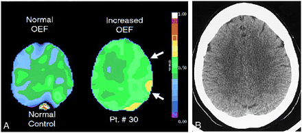 fig 4.