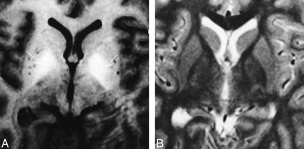 FIG 2.