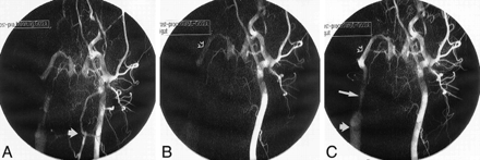 fig 2.