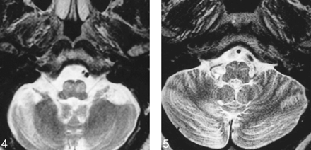 fig 4.