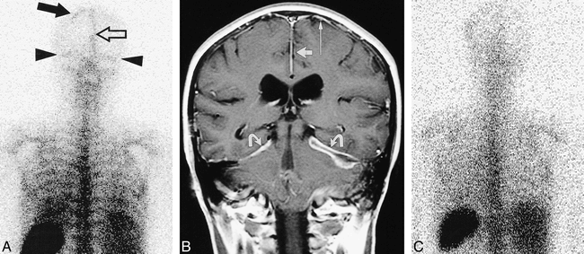 fig 2.