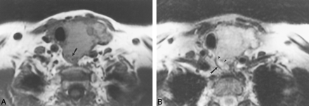 fig 4.
