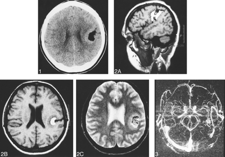 fig 1.