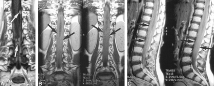 fig 3.