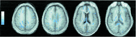 fig 1.