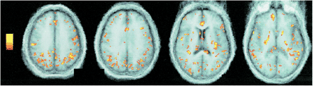 fig 2.