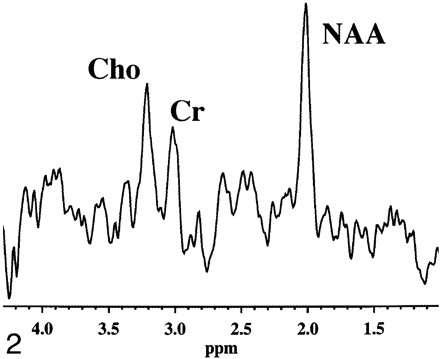 fig 2.