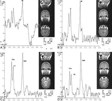 fig 3.