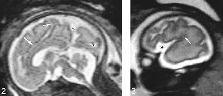 fig 2.