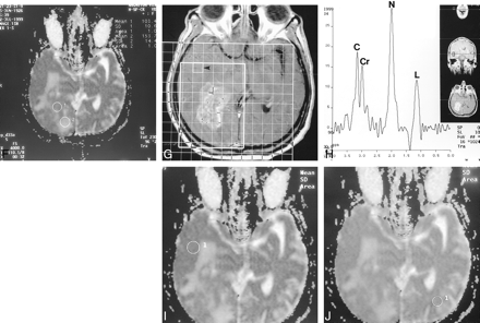 fig 1.