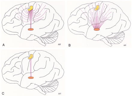 fig 3.