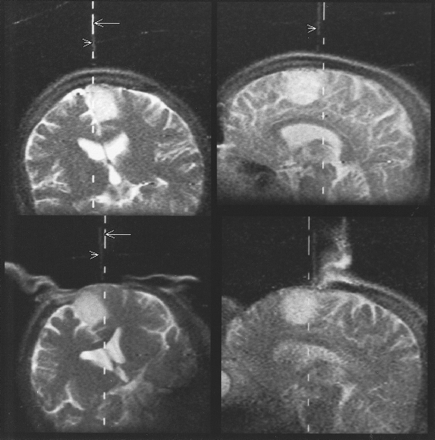 fig 2.