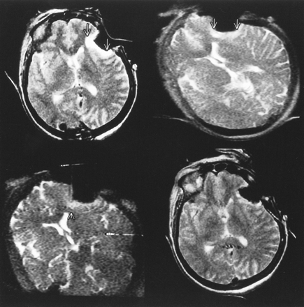fig 5.