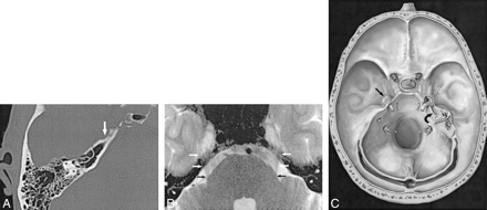 fig 1.