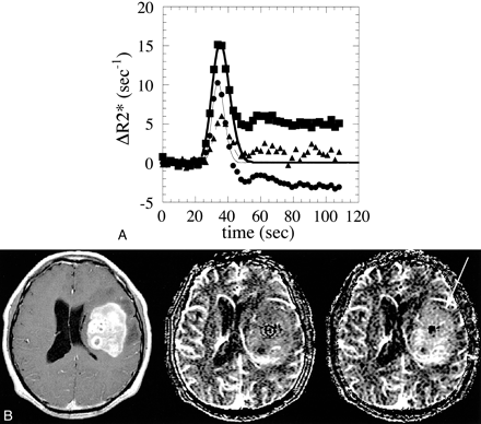 fig 1.