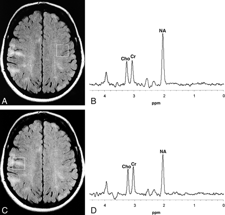 fig 2.