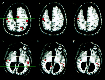 fig 4.