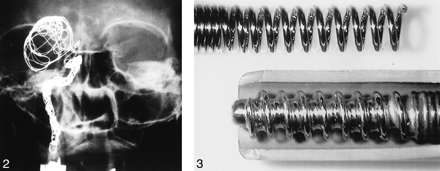 fig 2.
