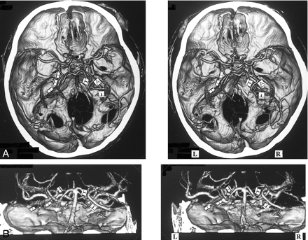 fig 6.
